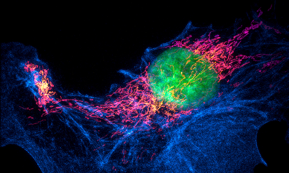 SUPERRESOLUTION MICROSCOPY